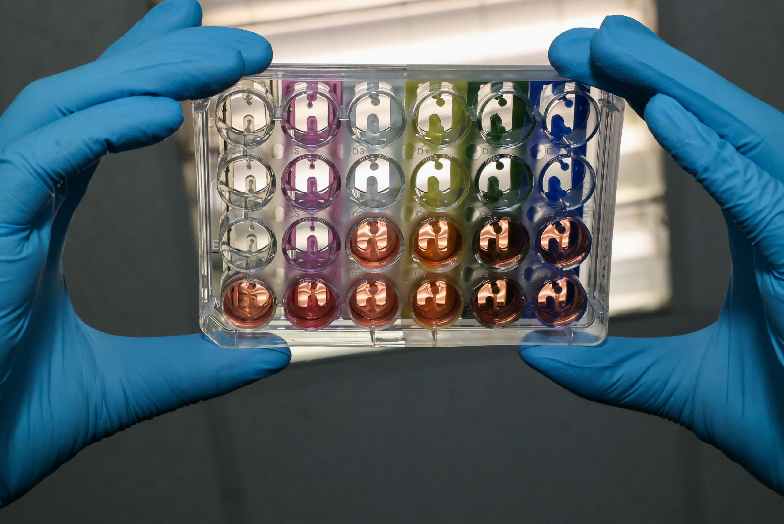 CAVD project: how to reconstitute in vitro mature contractile heart tissue?